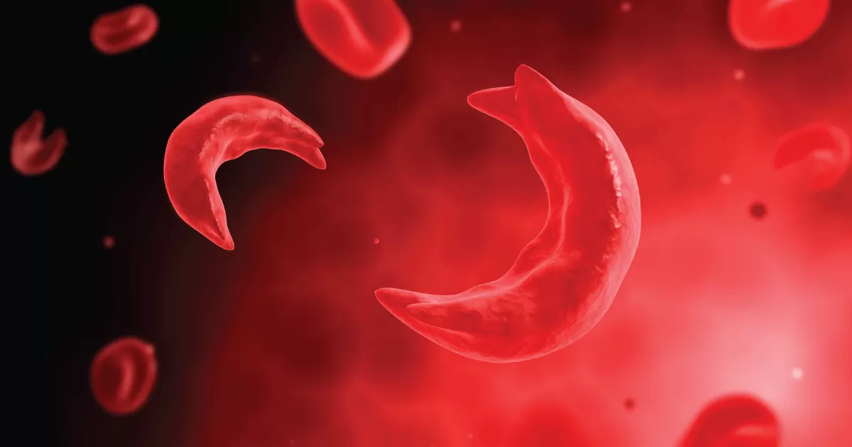 Sickle Cell Cure 2026: Inside the Gene Therapy Breakthrough Giving Patients Their Lives Back